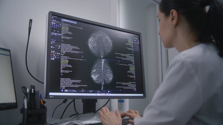 Más allá del positivo o negativo: plantean que el cáncer de mama se defina como un "espectro"