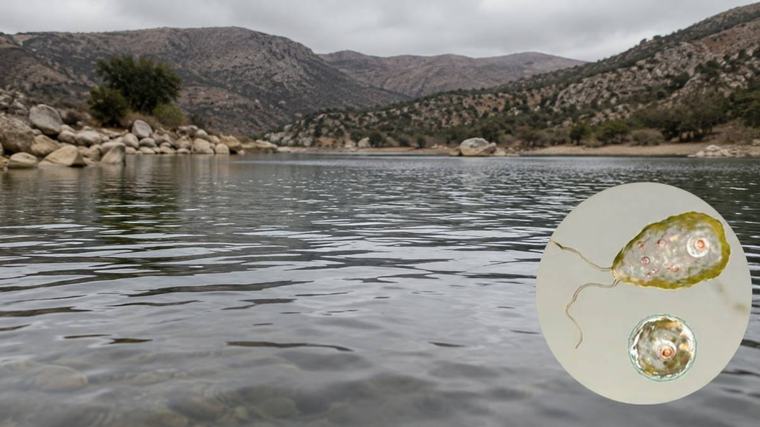 Infecciosas | Muere una niña de 8 años tras contraer la ameba ‘comecerebros’ en un lago: cómo evitarla y cuáles son sus síntomas